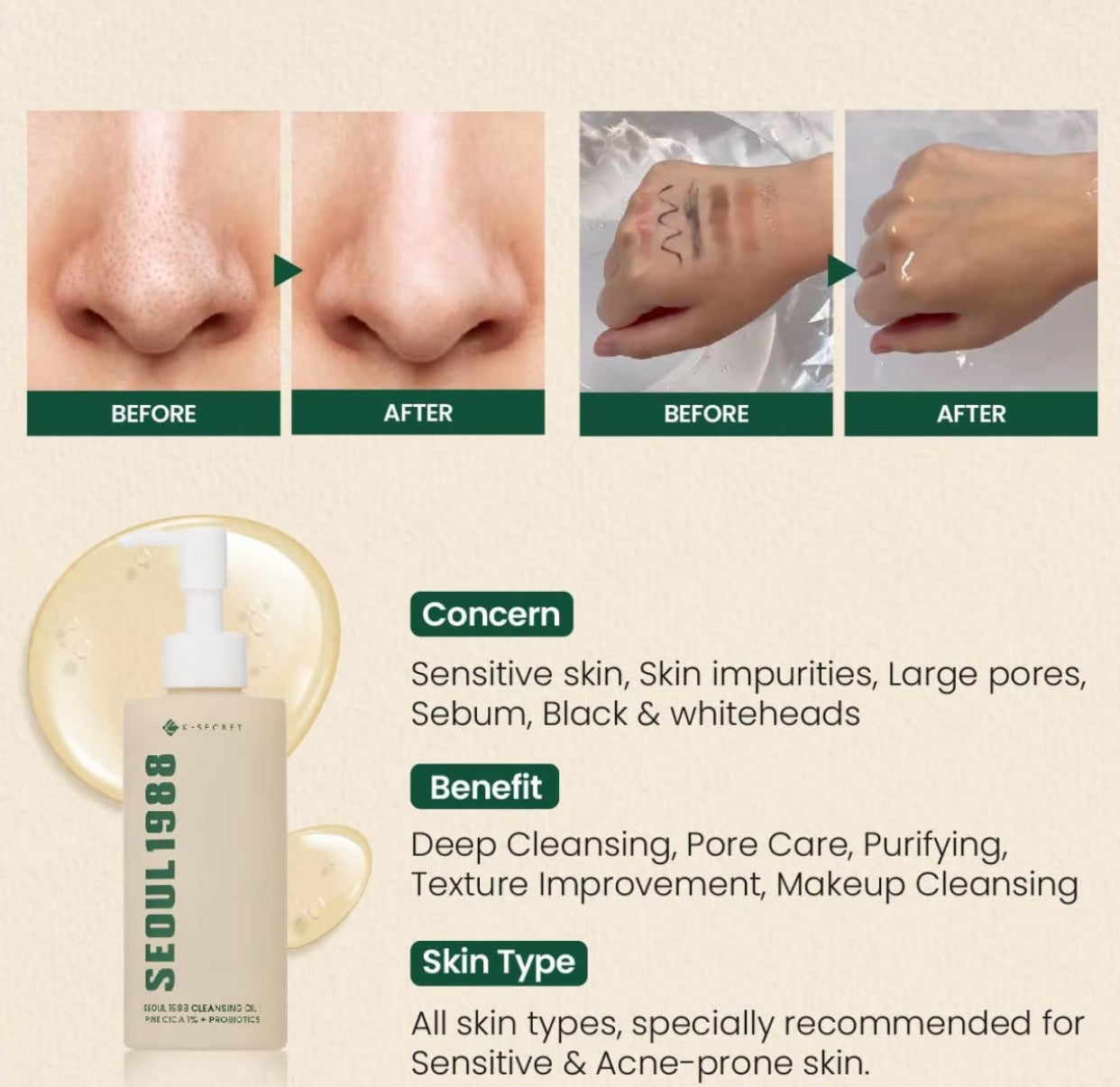 K-secret - SEOUL 1988 Cleansing Oil Pine Cica 1% + Probiotics 200ml - huile nettoyante